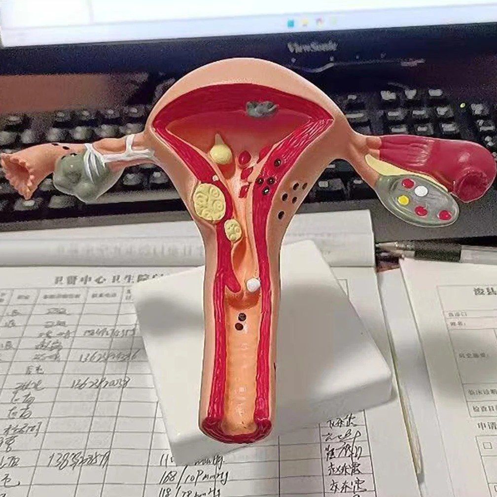 Modellbausätze & Standmodelle: 📌 NEU Gebärmutter Anatomisches Modell – Neu und originalverpackt aus Wittenbach von ChinaSeidenstrasse 5
