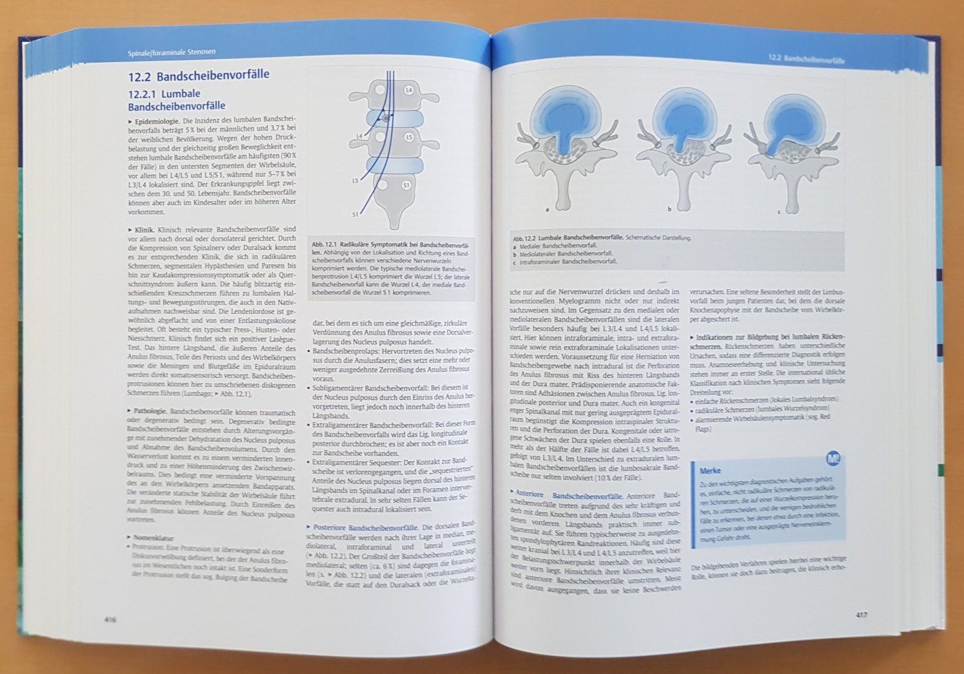 Libri: Sachbuch "MRT des Zentralnervensystems" – Usato da Schaffhausen venduto da asyouwestley 5