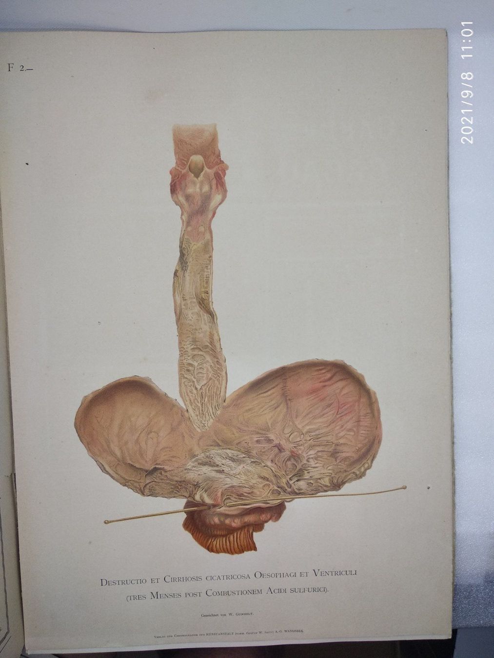 Libri: MEDIZIN - ANATOMIE - KAST - RUMPEL - P – Usato da Goldach venduto da Gaip 3