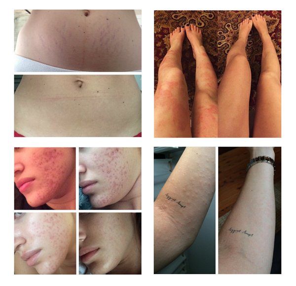 Sonstige Körperpflege: Frank Body Shimmer Coffee Scrub Peeling - NEU!! – Neu und originalverpackt aus Cham von Trendy_Outlet 5