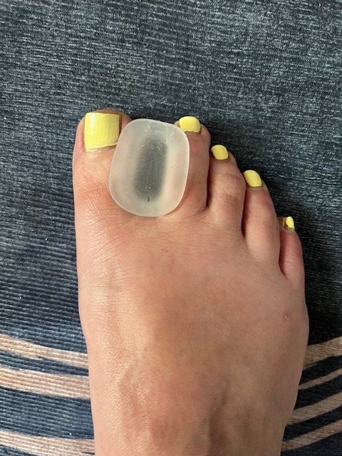 Pedicure: Zehenspreizer G klein – Nuovo (secondo la descrizione) da Nottwil venduto da Frontal 5