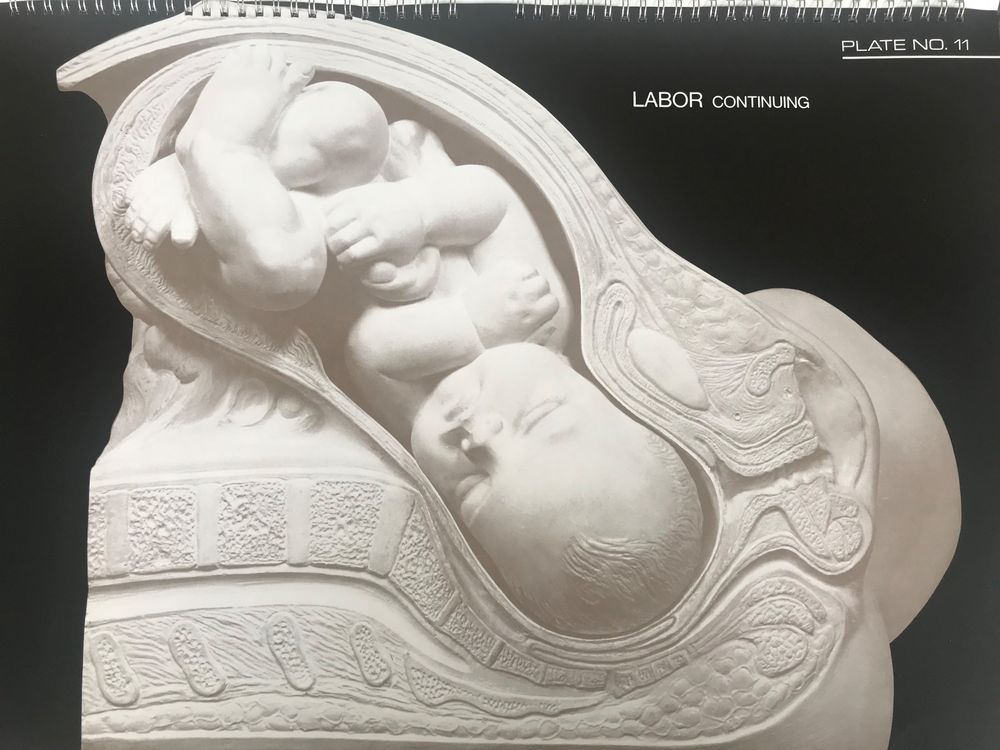 Birth atlas geburtsatlas kaufen auf ricardo
