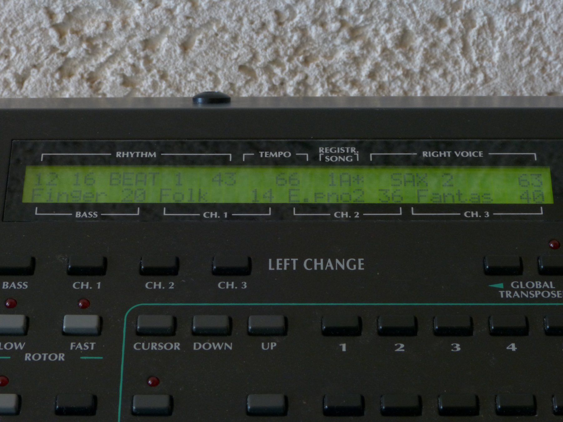 Solton Strumenti musicali: Solton MS 5 Multi Synthesis Keyboard + Koffer + 2 Pedalen – Usato da Rheineck venduto da mur.man 6