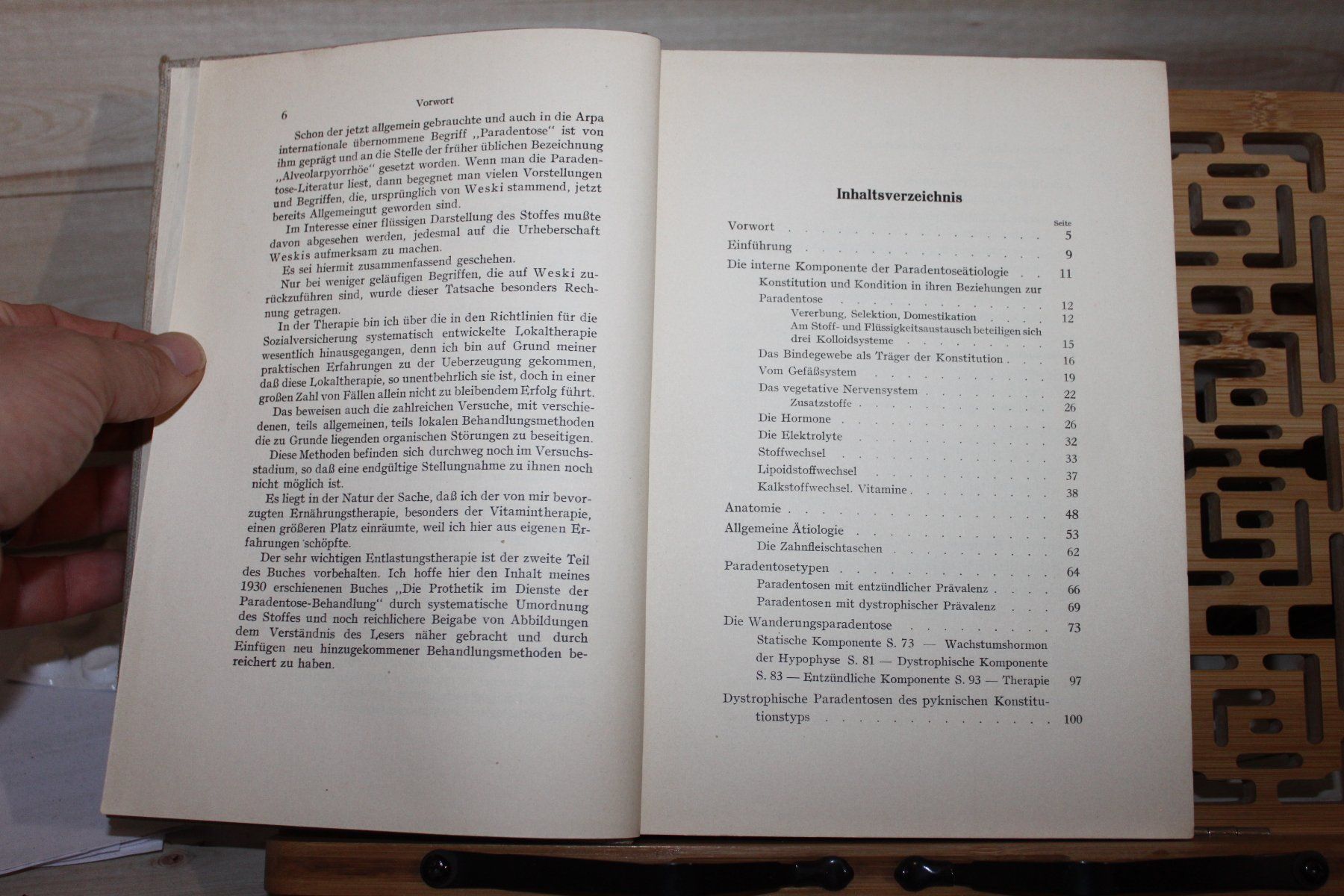 Libri: Paradentose- Walter Stärke 1937 – Usato da Kaden venduto da Buchantiquariat 2