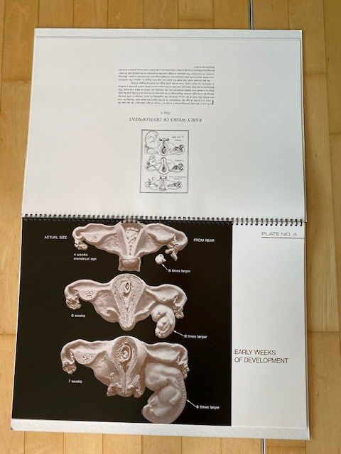 Bücher: Birth Atlas R. Dickinson – Gebraucht aus Edlibach von Arnoldotto 4