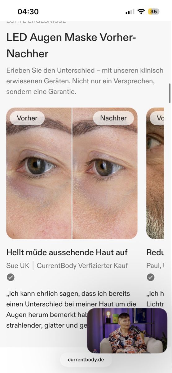 Attrezzature mediche: LED Maske (Augen) Currentbody – Usato da Kriessern venduto da hannawber 4