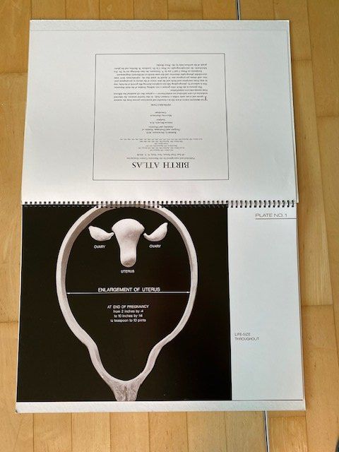 Bücher: Birth Atlas R. Dickinson – Gebraucht aus Edlibach von Arnoldotto 1