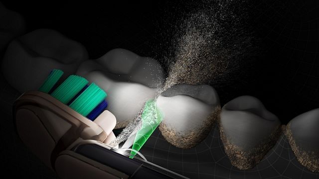 Cura dei denti: New Dyson Camerajet – Nuovo e nell'imballaggio originale da Grand-Lancy venduto da 50plus50 2