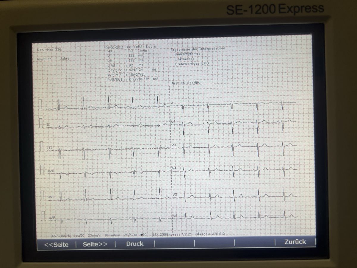 Attrezzature mediche: EKG Messgerät Edan SE-1200 Express Touchscreen – Usato da Umiken venduto da mar_p7n9 2