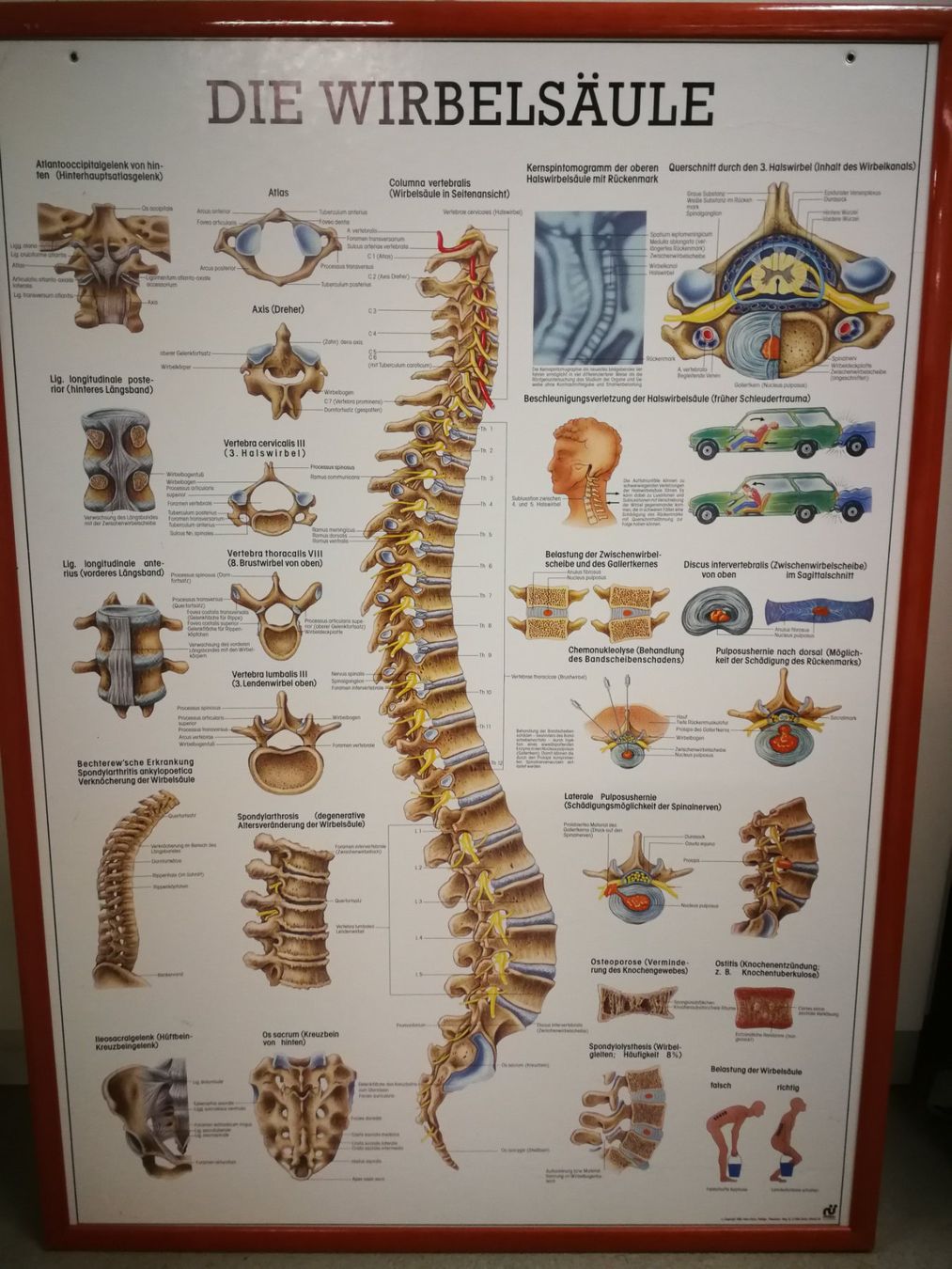 Foto & Immagini: 5 Anatomische Bilder/ Plakate eingerahmt – Usato da Horgen venduto da lemisk 2