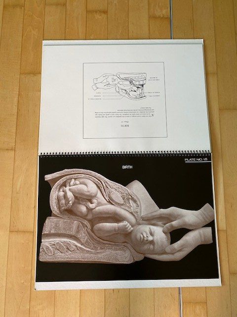Bücher: Birth Atlas R. Dickinson – Gebraucht aus Edlibach von Arnoldotto 5