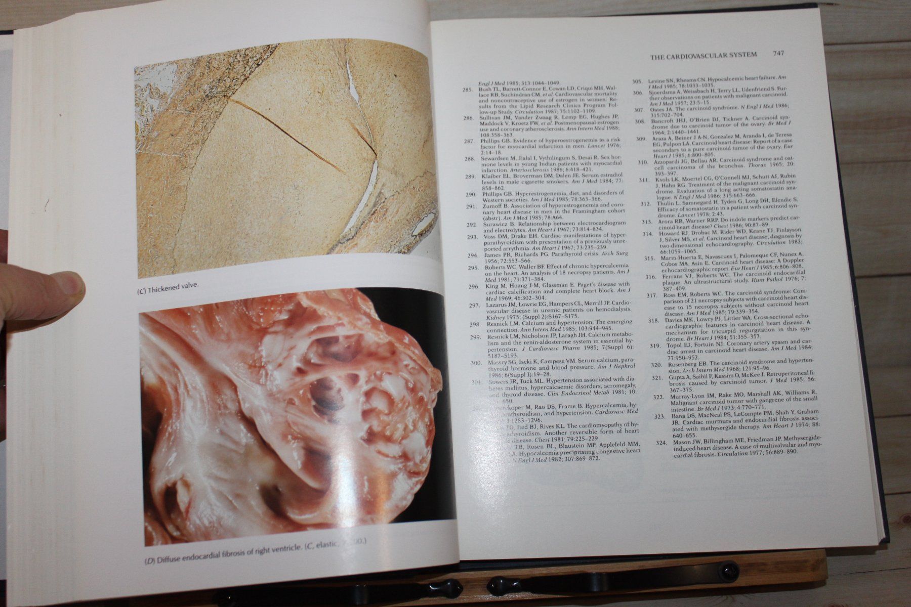 Libri: Functional Endocrine Pathology Vol. I+II – Usato da Kaden venduto da Buchantiquariat 4