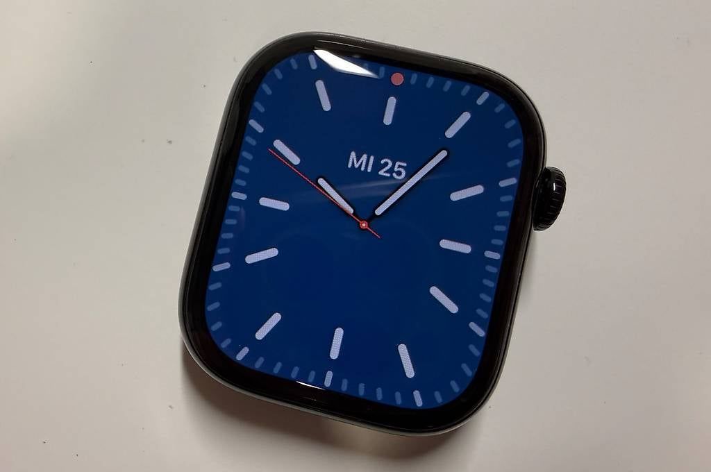 Apple Smartwatch: Apple Watch Series 10, 42 mm LTE – Usato da Oberönz venduto da shirtsign