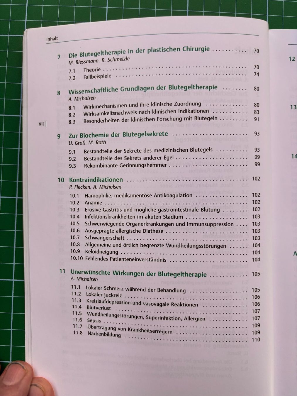 Bücher: Blutegeltherapie Verlag Thieme, farbig, 149 S. – Gebraucht aus Wald ZH von ukulele77 5