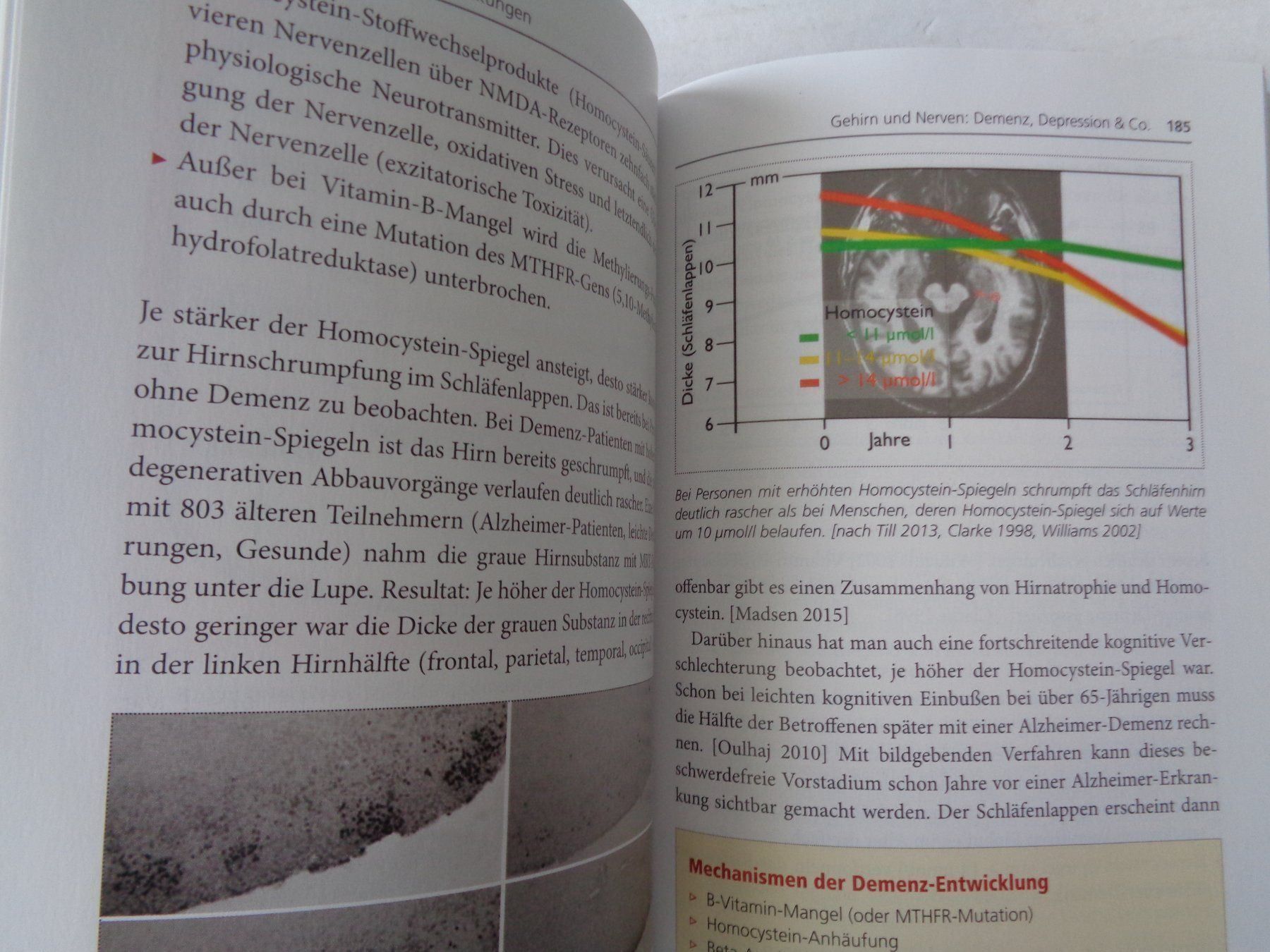 Livres: Vitamin B12 - Eberhard J.Wormer – D'occasion à Chur par omonia 4