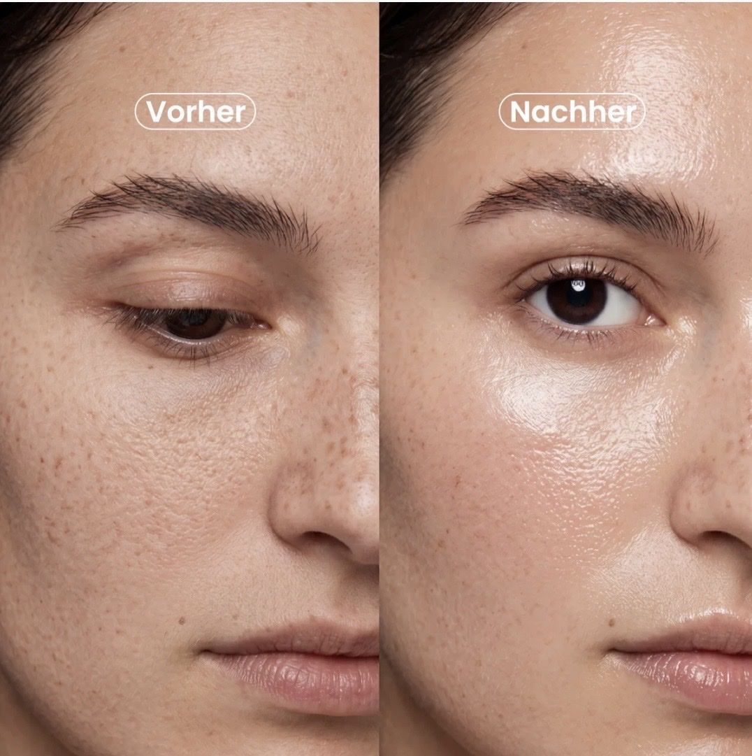 Cura del viso: Miiki- PDRN active boost Serum – Nuovo e nell'imballaggio originale da Reiden venduto da LisiC 6