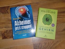 Alzheimer jetzt Stoppen ,Erneuere dein Gehirn