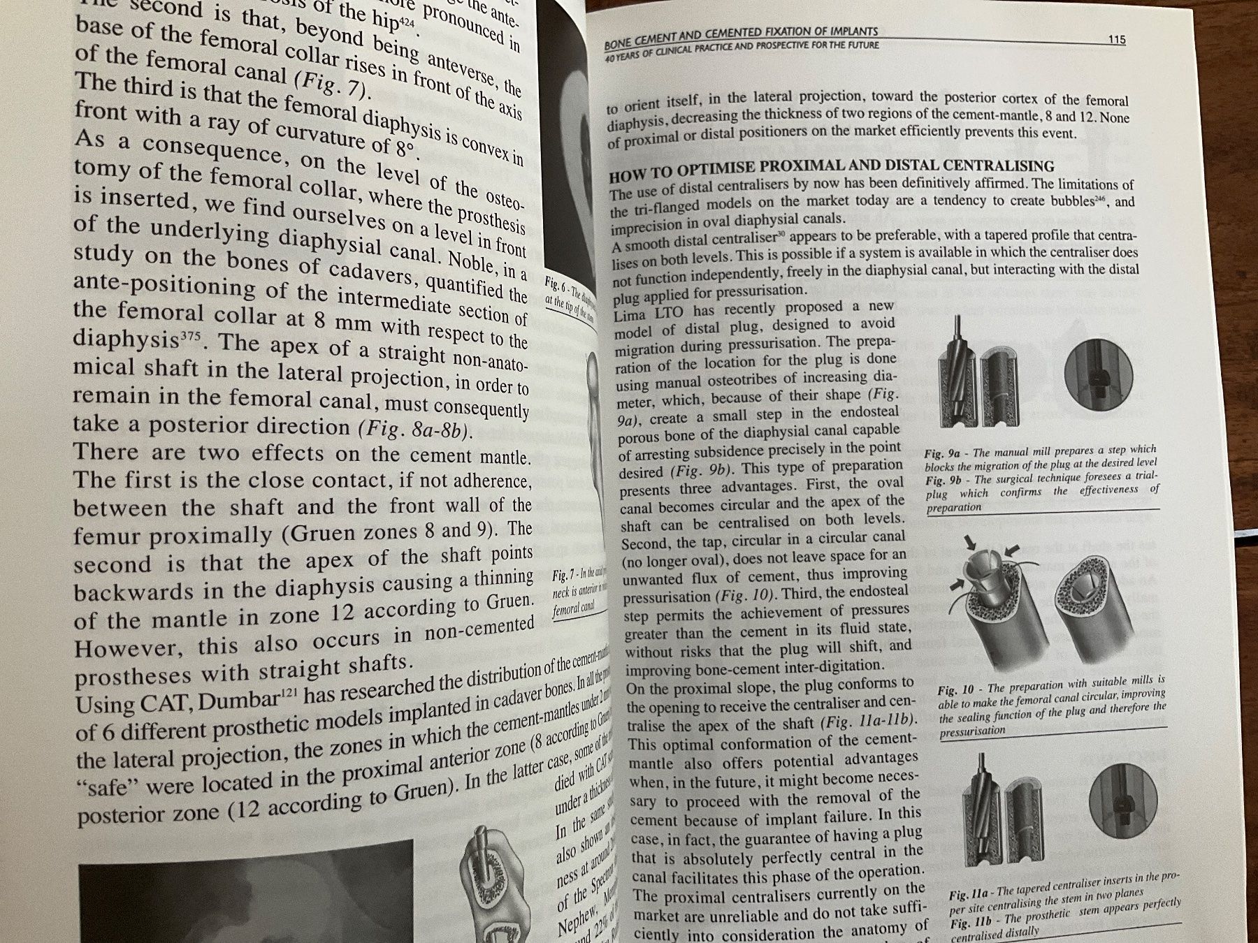 Livres: Bone Cement and Cemented Fixation of Implants📚2001 – D'occasion à Avenches par Lactobacille 1
