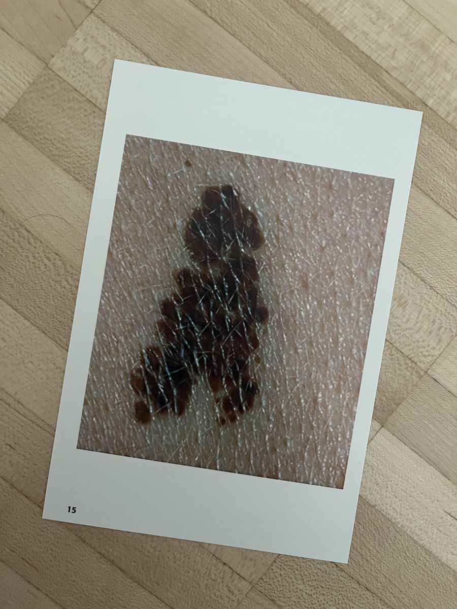 Libri: Dermatologie Lernkarten – Nuovo (secondo la descrizione) da Luzern venduto da jodermatt 1