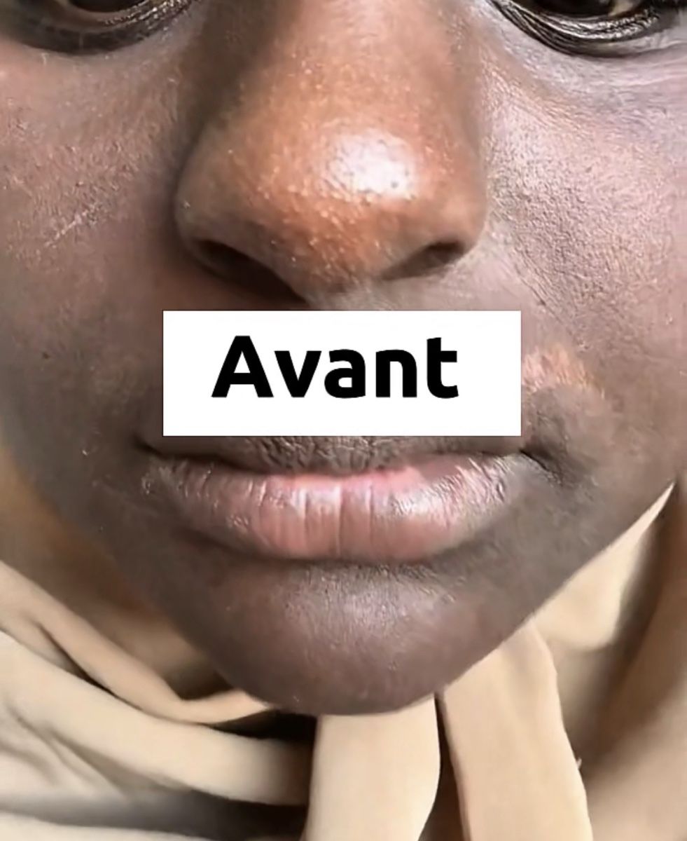 Cura del viso: Savon anti-tâches – Nuovo e nell'imballaggio originale da Genève venduto da tch_dw9w 1