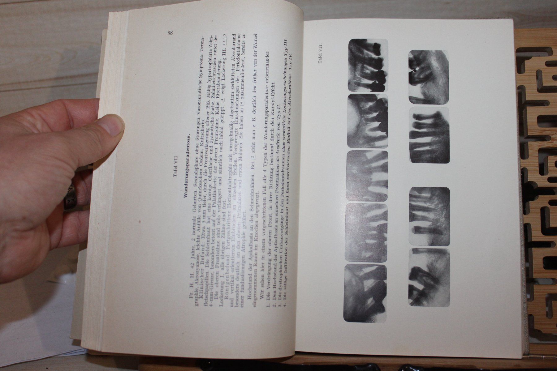Libri: Paradentose- Walter Stärke 1937 – Usato da Kaden venduto da Buchantiquariat 4