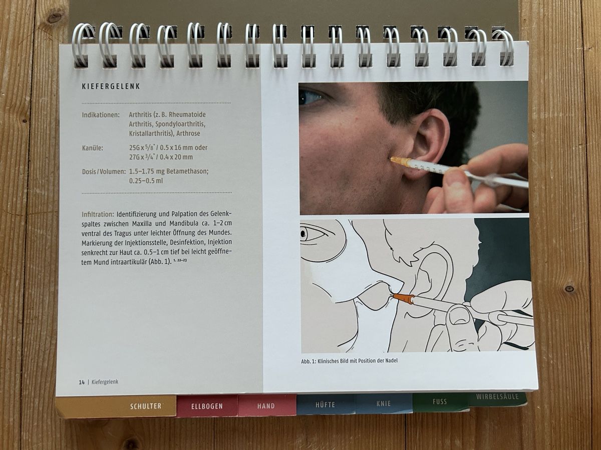 Libri: Injektionstechnik peripherer Gelenke – Usato da Himmelried venduto da rasmus67 3