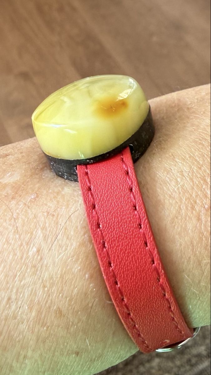 Bracciali & Braccialetti: Bernstein-Armband auf Lederband – Nuovo e nell'imballaggio originale da Ebikon venduto da elischka 3
