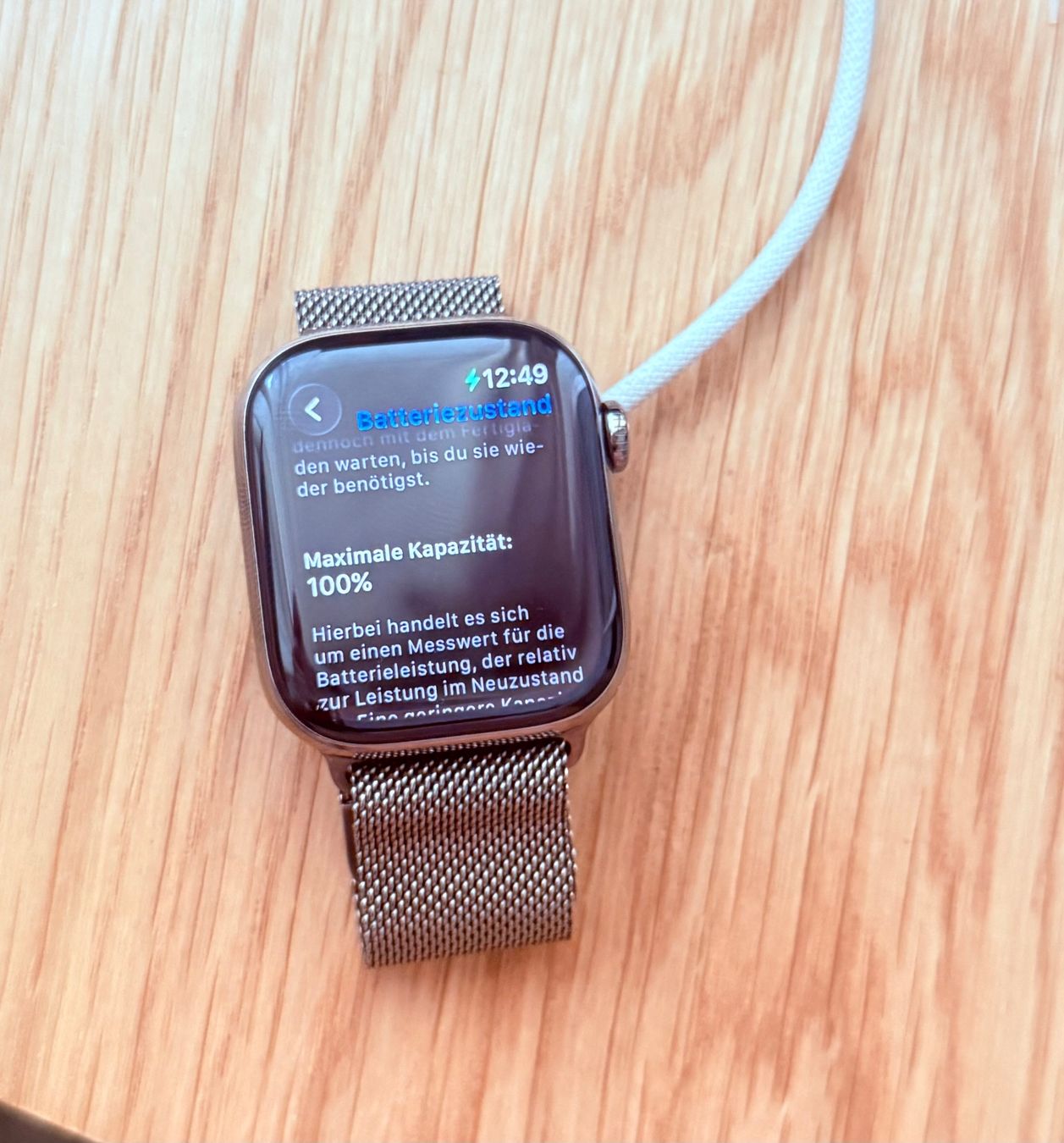 Apple Smartwatch: Apple Watch Serie 11 42 mm Titan – Usato da Grenchen venduto da Raluca29 3