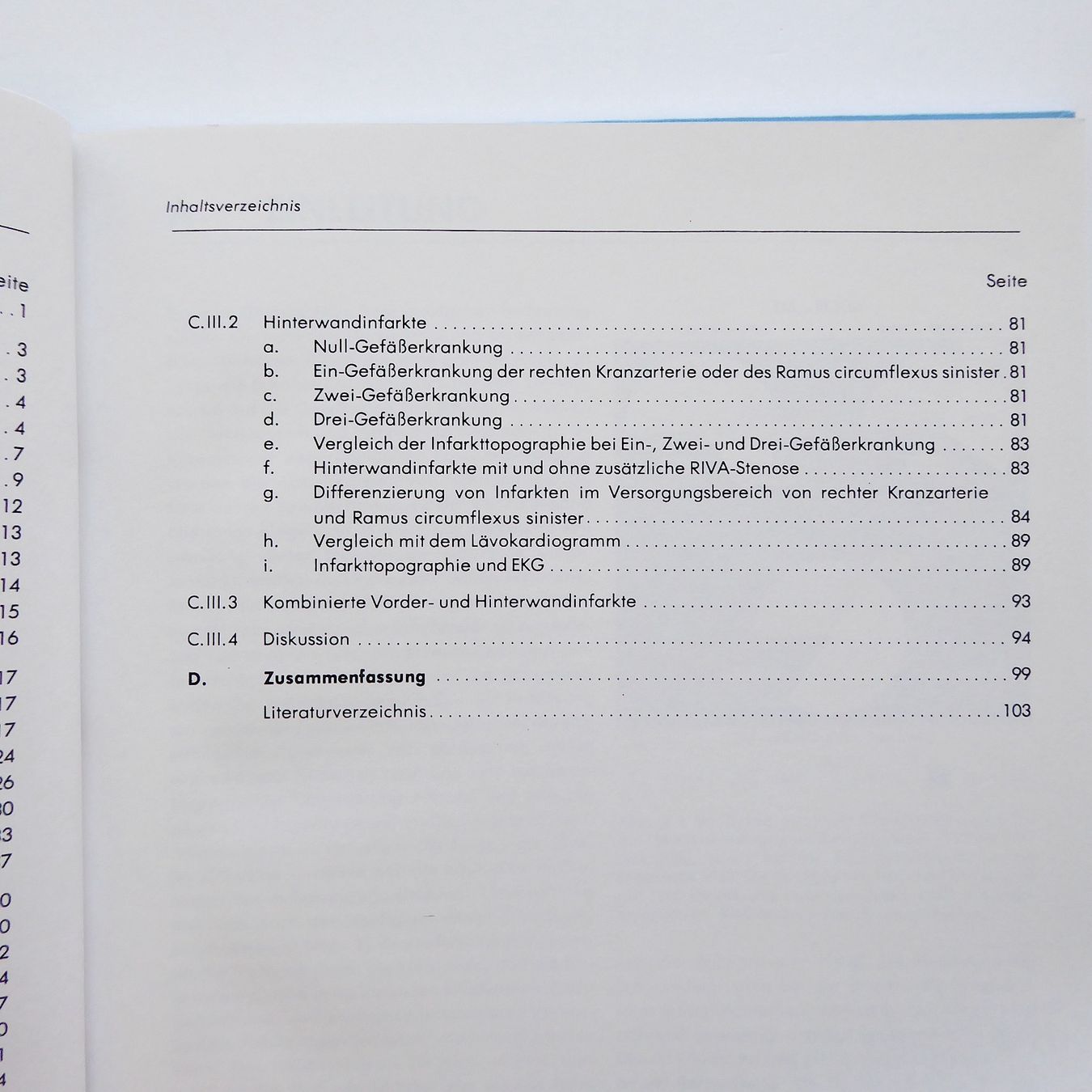 Bücher: Qualitative und quantitative 2D-echokardiographische Topogra – Gebraucht aus Basel von Kunterbunt12 3