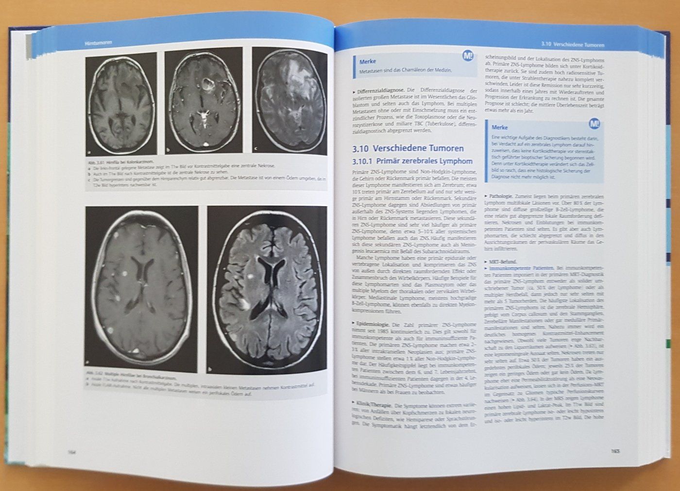 Libri: Sachbuch "MRT des Zentralnervensystems" – Usato da Schaffhausen venduto da asyouwestley 4