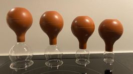 Schröpfgläser