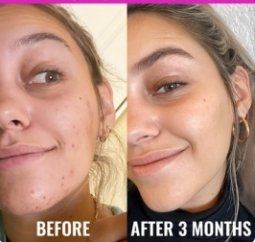 Cura del viso: Good Molecules Niacinamide Texture & Pore Refining Set – Nuovo e nell'imballaggio originale da Cham venduto da Trendy_Outlet 3