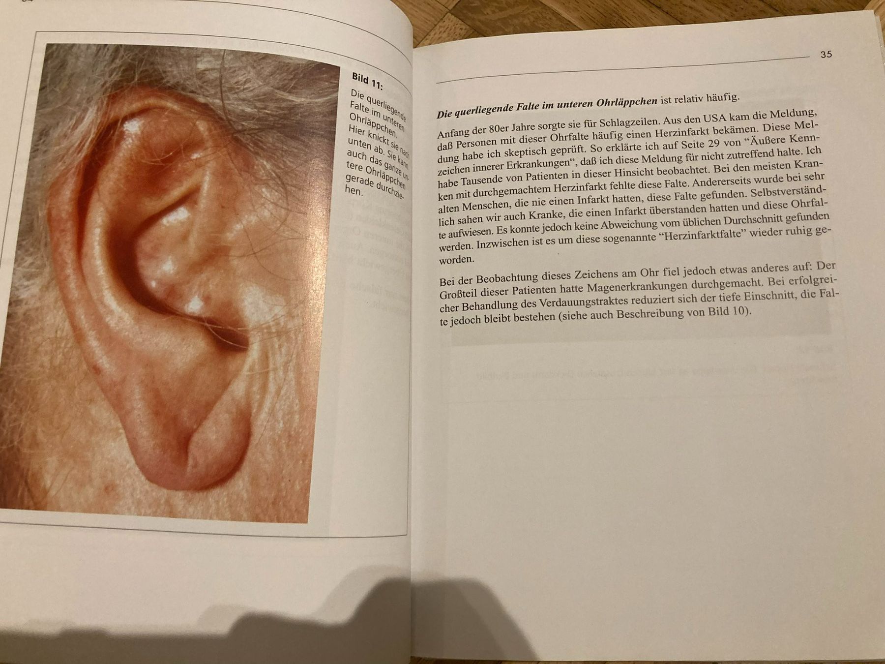 Libri: Sprechende Gesichter / Blickdiagnosen – Usato da Niederscherli venduto da ypsilon315 1