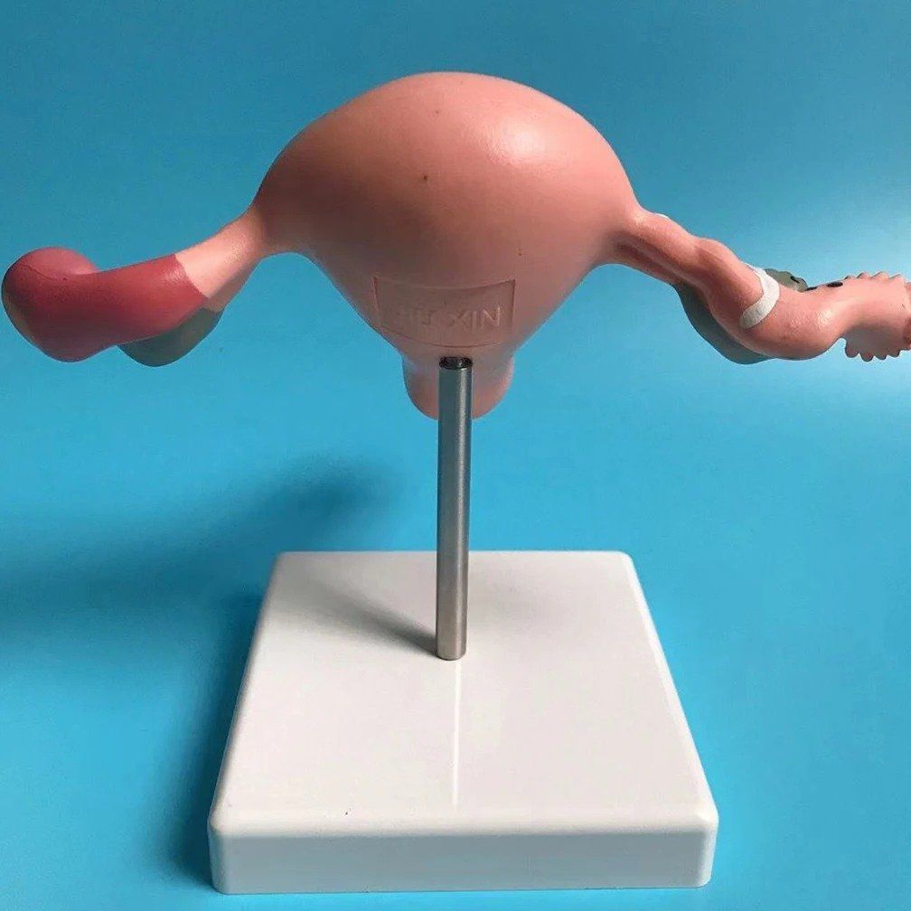 Modellbausätze & Standmodelle: 📌 NEU Gebärmutter Anatomisches Modell – Neu und originalverpackt aus Wittenbach von ChinaSeidenstrasse 2