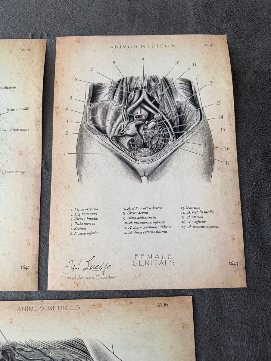 Dipinti: Anatomische ArtPrinte Gemälde Gynäkologie – Usato da St. Gallen venduto da Blackmoon_Flohmarkt 2
