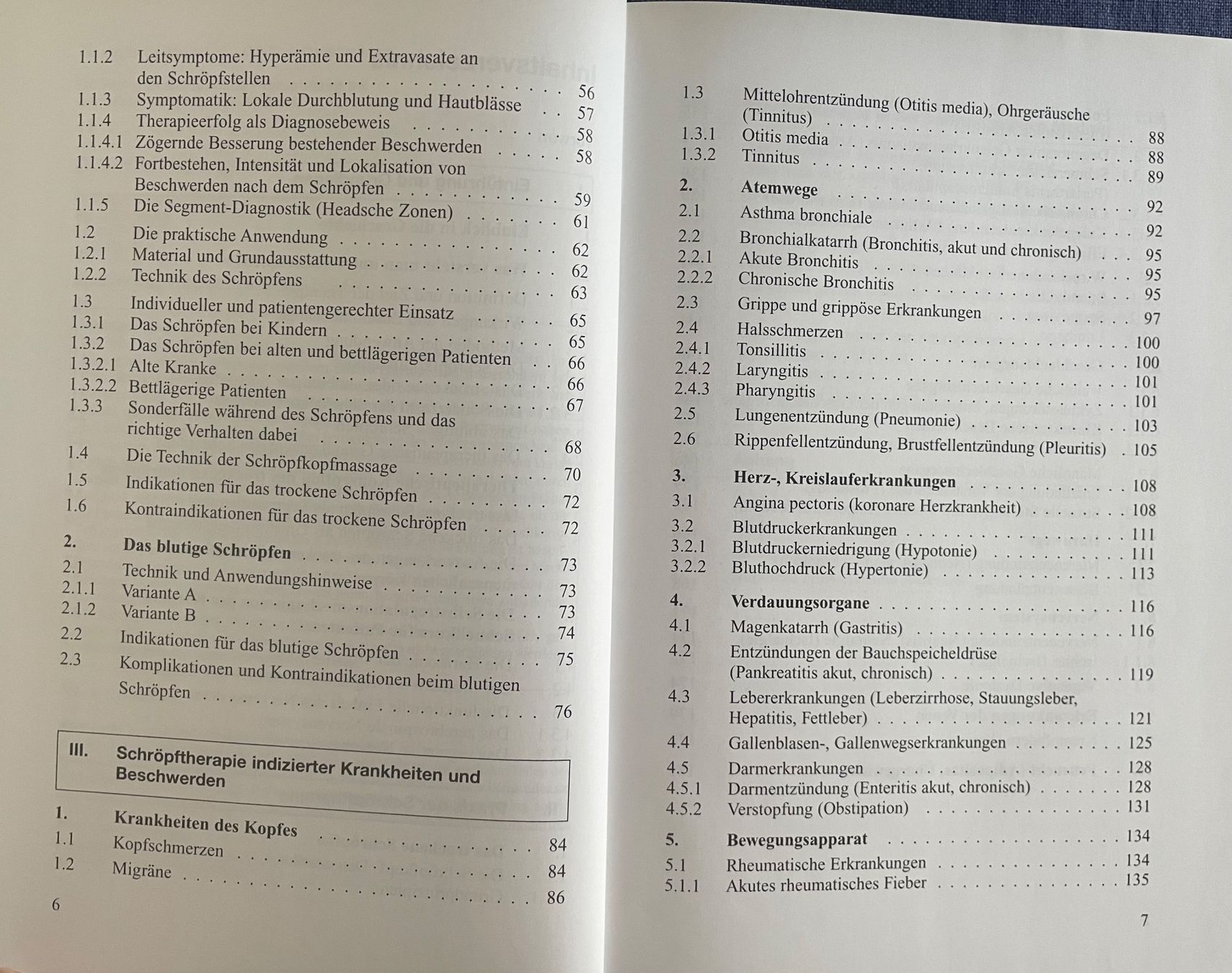 Bücher: Die Kunst des Schröpfens – Neu (gemäss Beschreibung) aus Kriens von Mayang 3