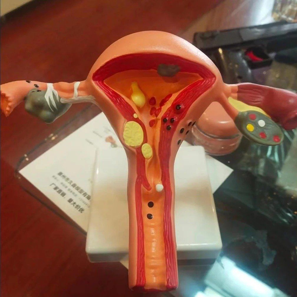 Modellbausätze & Standmodelle: 📌 NEU Gebärmutter Anatomisches Modell – Neu und originalverpackt aus Wittenbach von ChinaSeidenstrasse 4