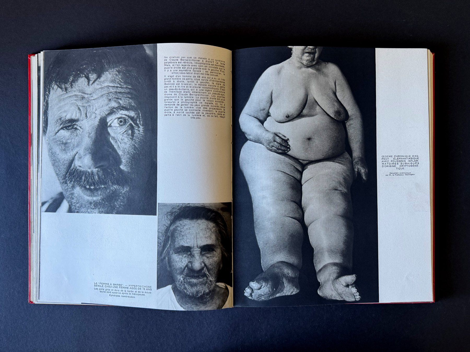 Libri: La collection des Documents Médicaux. Robert Lang. Paris. – Usato da Zürich venduto da Tulsa1968 8