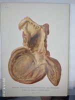 MEDIZIN - ANATOMIE - KAST - RUMPEL - P