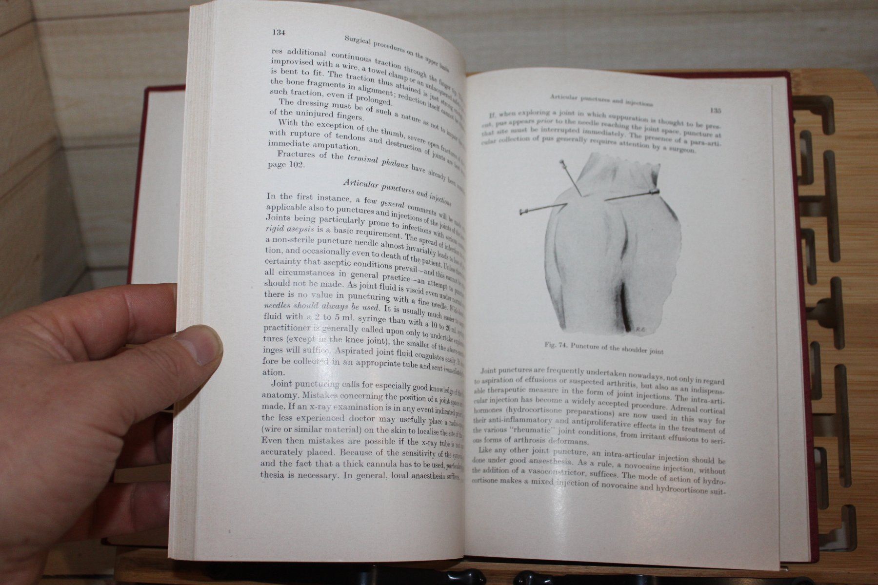 Libri: Operations in the practitioner`s surgery-G.Jorns 1963 – Usato da Kaden venduto da Buchantiquariat 4