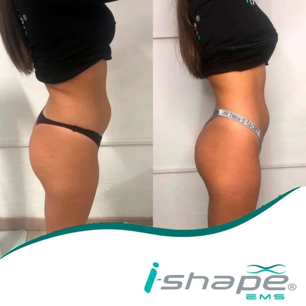 Appareils de massage: i-model esthetic  – Neuf (Voir description) à Frauenfeld par ren_8xzb 7