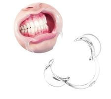 Für Mundöffner Dental C-Form Zahnreinig Mundwinkelhalter