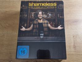 Shameless - Die komplette Serie NEU OVP DVD