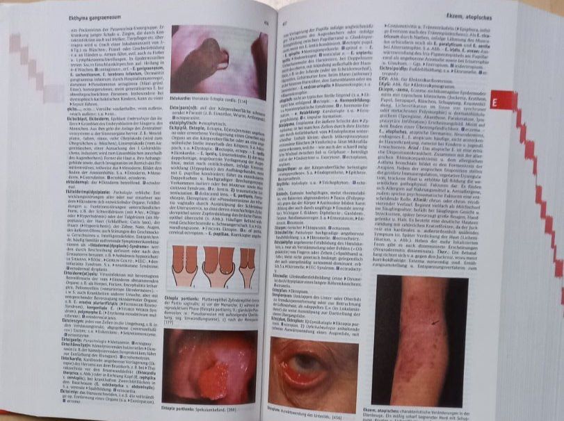 Libri: Roche Lexikon – Nuovo (secondo la descrizione) da Trin Mulin venduto da jerb 2