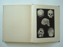 Antikes Schädel-Buch von 1907 – Skelett – Totenkopf