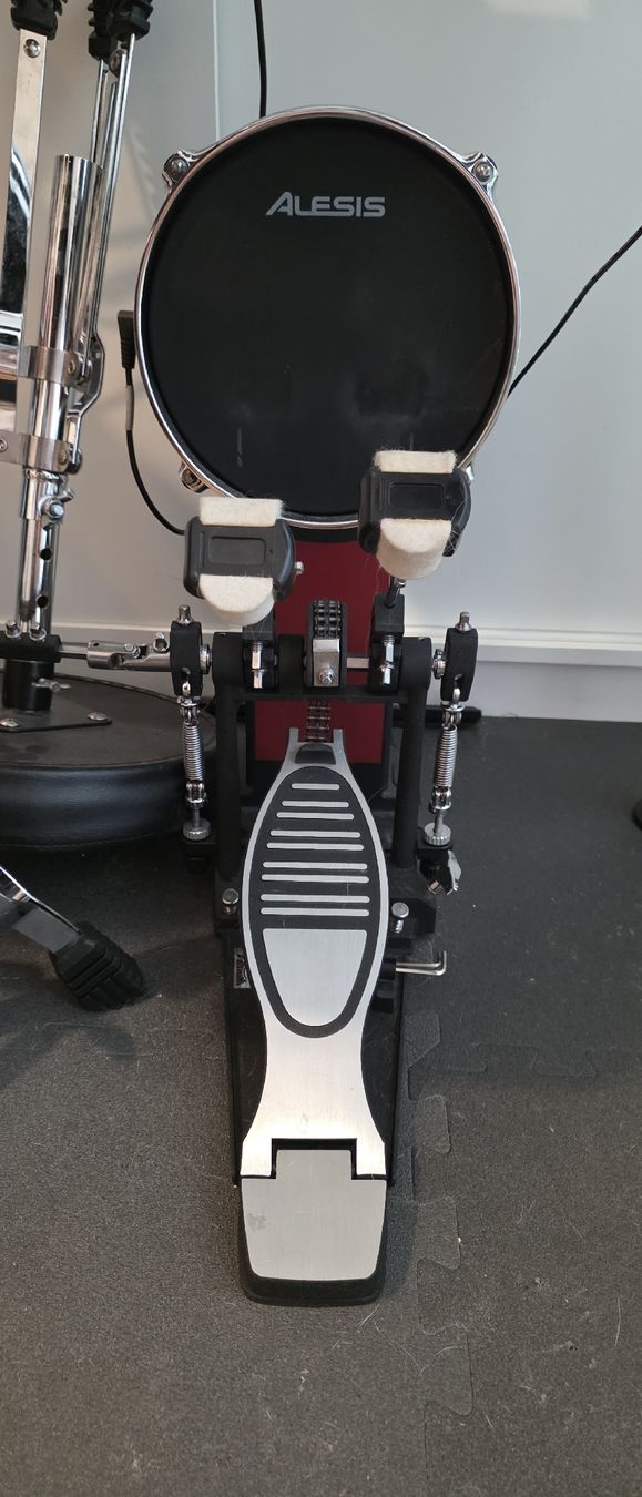 Alesis Strumenti musicali: Alesis Crimson II E-Drum Kit – Usato da Sevelen venduto da JohnnyDeath88 4