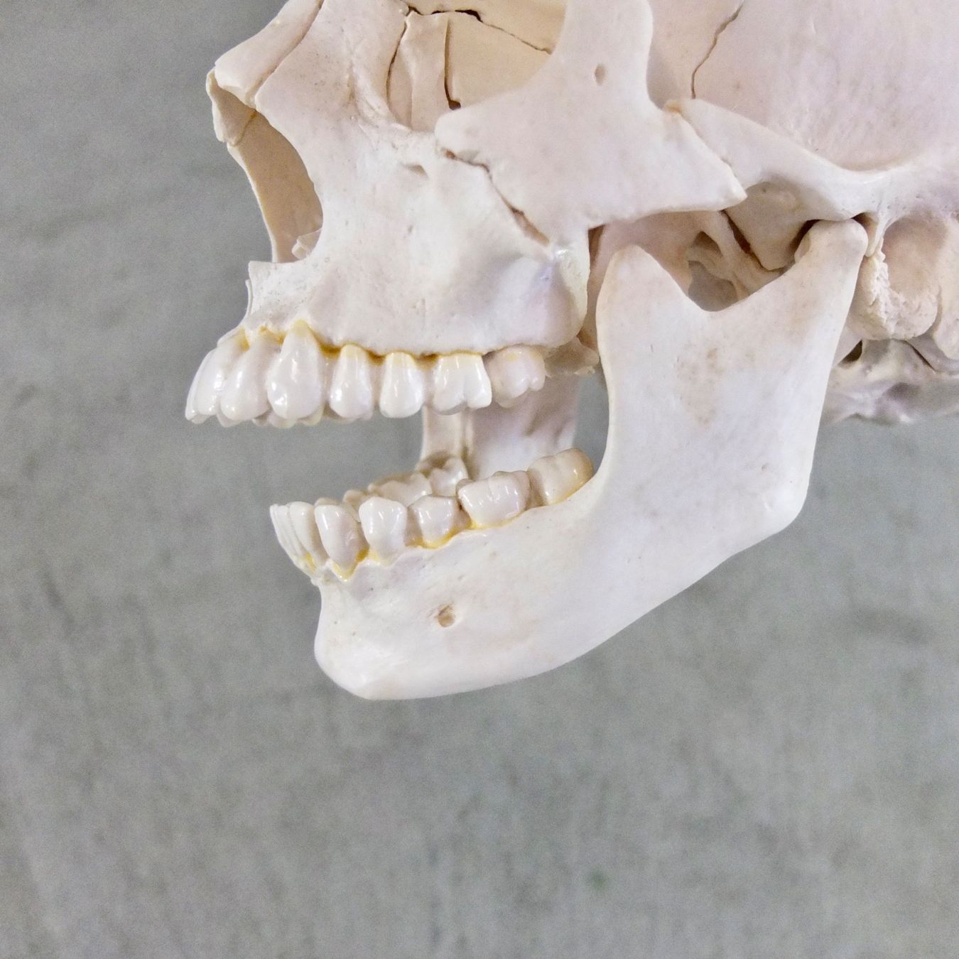 Attrezzature mediche: 3B Scientific Beauchene-Schädel, 22-teilig – Usato da Basel venduto da Brocki-auf-dem-Wolf 8