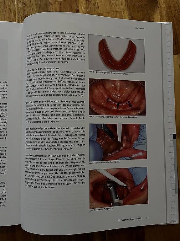 Libri: ITI Treatment Guide Band 9 Deutsch – Usato da Neuhausen am Rheinfall venduto da ram_kw6n 3
