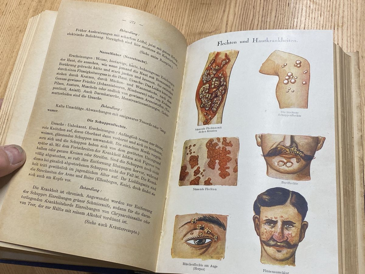 Libri: Selbsthilfe Gesundheitsbuch um 1900 – Usato da Mosnang venduto da Goldwasser 3