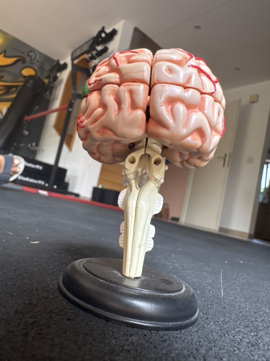 Modellbausätze & Standmodelle: Modèle cerveau anatomique pour démonstration, pièce manquant – Gebraucht aus Pâquier-Montbarry von ada_w658 1